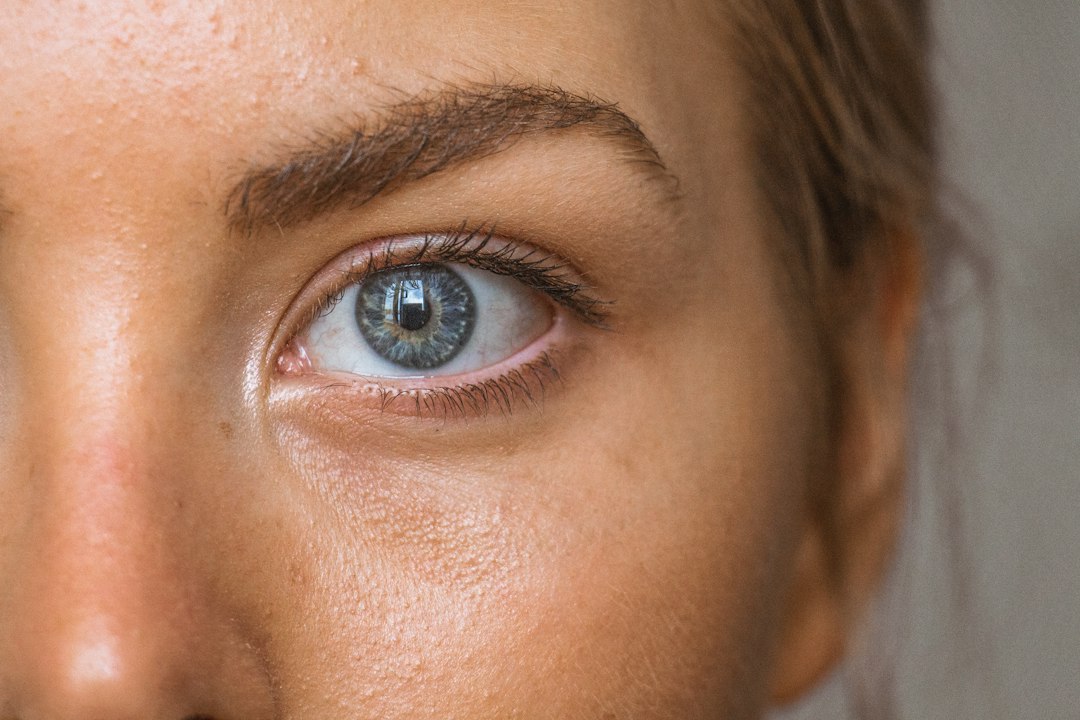 Dry Eye Syndrome in Adults: Causes, Symptoms, and Natural Relief Strategies
