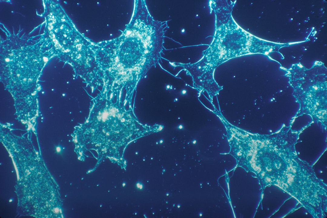 Oxidative Stress and Eye Damage: How Free Radicals Affect Vision